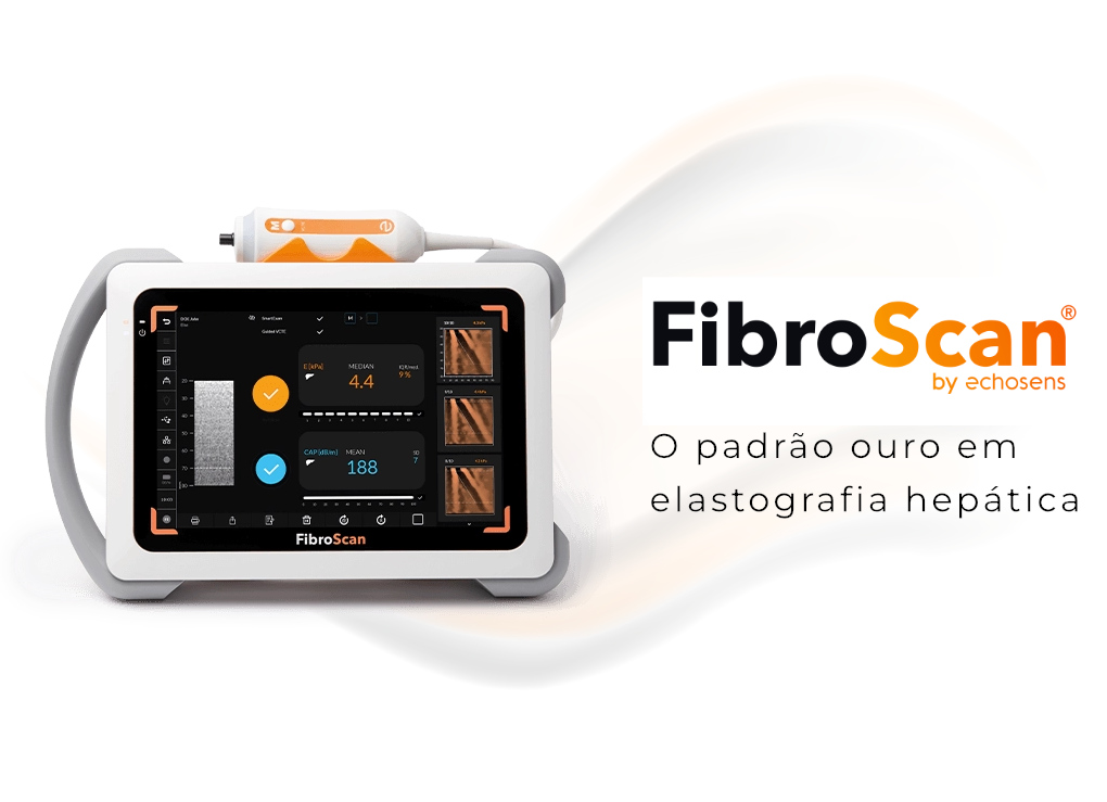 FibroScan - Saiba mais sobre esse exame